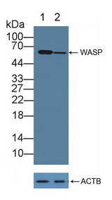 WAS / WASP Antibody - Knockout Varification: Lane 1: Wild-type hl60 cell lysate; Lane 2: WASP knockout hl60 cell lysate; Predicted MW: 53kd Observed MW: 60kd Primary Ab: 1µg/ml Rabbit Anti-Human WASP Antibody Second Ab: 0.2µg/mL HRP-Linked Caprine Anti-Rabbit IgG Polyclonal Antibody