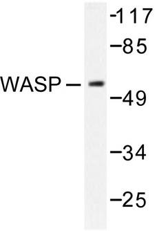 WAS / WASP Antibody - Western blot of WASP (E284) pAb in extracts from HepG2 cells.