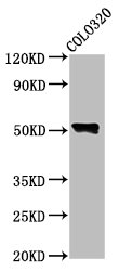 WAS / WASP Antibody - Positive Western Blot detected in COLO320 whole cell lysate. All lanes: WAS antibody at 4.6 µg/ml Secondary Goat polyclonal to rabbit IgG at 1/50000 dilution. Predicted band size: 53 KDa. Observed band size: 53 KDa