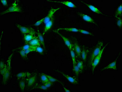 WAS / WASP Antibody - Immunofluorescence staining of Hela cells with WAS Antibody at 1:150, counter-stained with DAPI. The cells were fixed in 4% formaldehyde, permeabilized using 0.2% Triton X-100 and blocked in 10% normal Goat Serum. The cells were then incubated with the antibody overnight at 4°C. The secondary antibody was Alexa Fluor 488-congugated AffiniPure Goat Anti-Rabbit IgG(H+L).