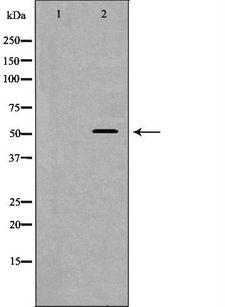 WAS / WASP Antibody - Western blot analysis of LOVO cells cell lysates using WAS antibody. The lane on the left is treated with the antigen-specific peptide.