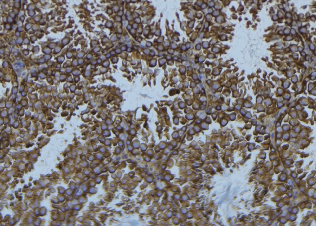 WAS / WASP Antibody - 1:100 staining mouse testis tissue by IHC-P. The sample was formaldehyde fixed and a heat mediated antigen retrieval step in citrate buffer was performed. The sample was then blocked and incubated with the antibody for 1.5 hours at 22°C. An HRP conjugated goat anti-rabbit antibody was used as the secondary.