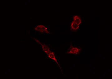 WAS / WASP Antibody - Staining HepG2 cells by IF/ICC. The samples were fixed with PFA and permeabilized in 0.1% Triton X-100, then blocked in 10% serum for 45 min at 25°C. The primary antibody was diluted at 1:200 and incubated with the sample for 1 hour at 37°C. An Alexa Fluor 594 conjugated goat anti-rabbit IgG (H+L) antibody, diluted at 1/600, was used as secondary antibody.
