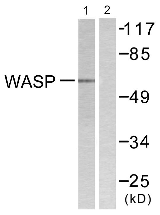 WAS / WASP Antibody - Western blot analysis of extracts from HepG2 cells, using WASP (Ab-290) antibody.