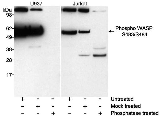 WAS / WASP Antibody - Detection of Human Phospho-WASP (S483/S484) by Western Blot. Samples: Whole cell lysate (50 ug/lane) from U937 and Jurkat cells. Lysates were either untreated, mock treated with phosphatase or treated with phosphatase. Antibody: Affinity purified rabbit anti-phospho WASP-S483/S484 antibody used at 1 ug/ml. Detection: Chemiluminescence with an exposure time of 30 seconds.