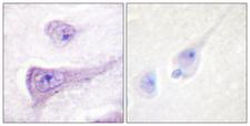 WAS / WASP Antibody - Immunohistochemistry analysis of paraffin-embedded human brain, using WASP (Phospho-Tyr290) Antibody. The picture on the right is blocked with the phospho peptide.
