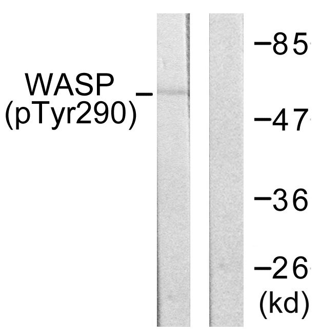 WAS / WASP Antibody - Western blot analysis of lysates from HepG2 cells, using WASP (Phospho-Tyr290) Antibody. The lane on the right is blocked with the phospho peptide.