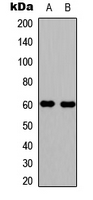 WAS / WASP Antibody - Western blot analysis of WASP (pY290) expression in Jurkat (A); TF1 (B) whole cell lysates.