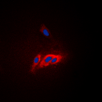 WAS / WASP Antibody - Immunofluorescent analysis of WASP (pY290) staining in HepG2 cells. Formalin-fixed cells were permeabilized with 0.1% Triton X-100 in TBS for 5-10 minutes and blocked with 3% BSA-PBS for 30 minutes at room temperature. Cells were probed with the primary antibody in 3% BSA-PBS and incubated overnight at 4 deg C in a humidified chamber. Cells were washed with PBST and incubated with a DyLight 594-conjugated secondary antibody (red) in PBS at room temperature in the dark. DAPI was used to stain the cell nuclei (blue).
