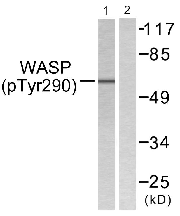 WAS / WASP Antibody - Western blot analysis of extracts from HepG2 cells, using WASP (Phospho-Tyr290) antibody.