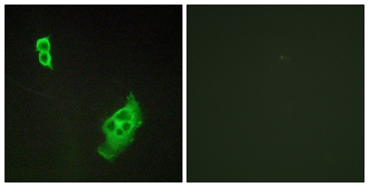 WASF1 / WAVE Antibody - Immunofluorescence analysis of COS7 cells, using WAVE1 Antibody. The picture on the right is blocked with the synthesized peptide.