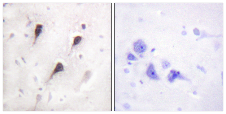 WASF1 / WAVE Antibody - Immunohistochemistry analysis of paraffin-embedded human brain tissue, using WAVE1 Antibody. The picture on the right is blocked with the synthesized peptide.