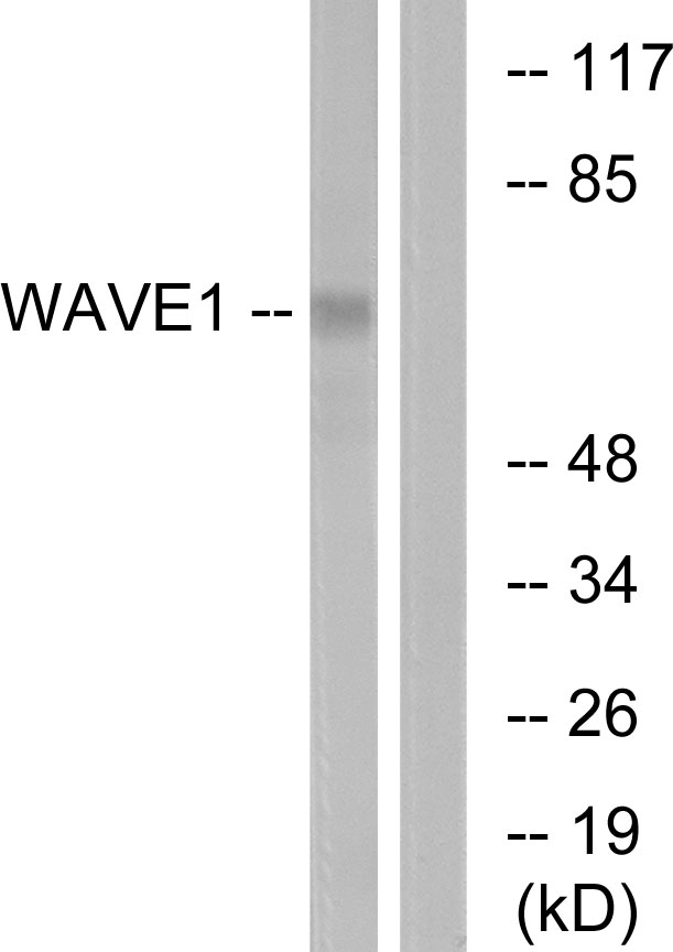 WASF1 / WAVE Antibody - Western blot analysis of lysates from 293 cells, treated with insulin 0.01U/ml 15', using WAVE1 Antibody. The lane on the right is blocked with the synthesized peptide.