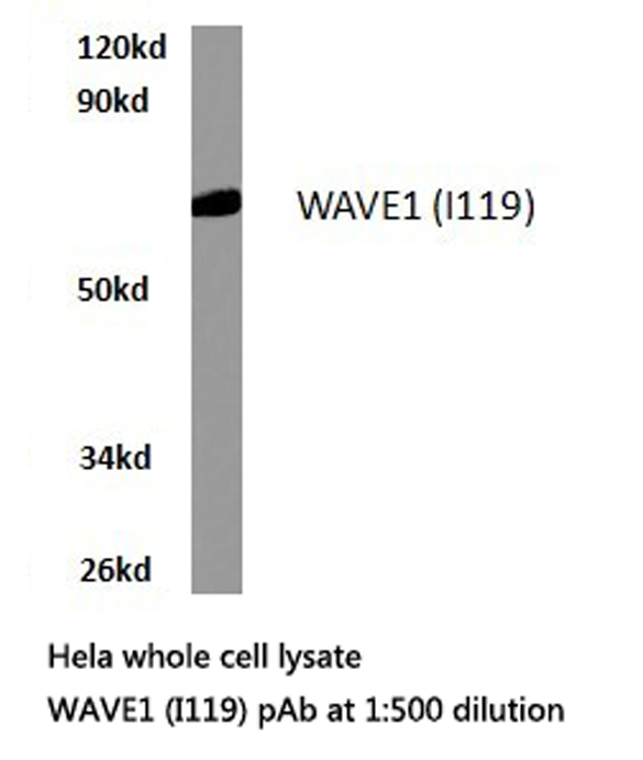WASF1 / WAVE Antibody - Western blot of WAVE1 (I119) pAb in extracts from HeLa cells.
