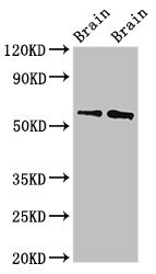 WASF1 / WAVE Antibody - Western Blot Positive WB detected in:Rat brain tissue,Mouse brain tissue All Lanes:WASF1 antibody at 3µg/ml Secondary Goat polyclonal to rabbit IgG at 1/50000 dilution Predicted band size: 62 KDa Observed band size: 62 KDa