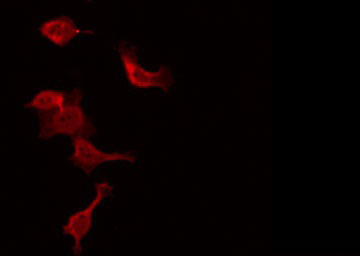 WASF1 / WAVE Antibody - Staining NIH-3T3 cells by IF/ICC. The samples were fixed with PFA and permeabilized in 0.1% Triton X-100, then blocked in 10% serum for 45 min at 25°C. The primary antibody was diluted at 1:200 and incubated with the sample for 1 hour at 37°C. An Alexa Fluor 594 conjugated goat anti-rabbit IgG (H+L) Ab, diluted at 1/600, was used as the secondary antibody.