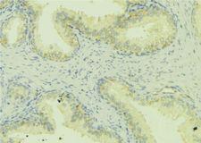 WASF1 / WAVE Antibody - 1:100 staining mouse colon tissue by IHC-P. The sample was formaldehyde fixed and a heat mediated antigen retrieval step in citrate buffer was performed. The sample was then blocked and incubated with the antibody for 1.5 hours at 22°C. An HRP conjugated goat anti-rabbit antibody was used as the secondary.