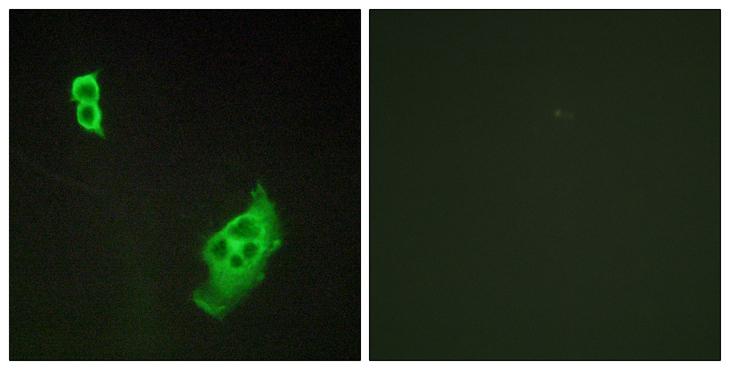 WASF1 / WAVE Antibody - Peptide - + Immunofluorescence analysis of COS-7 cells, using NFAT3 (Ab-676) antibody.
