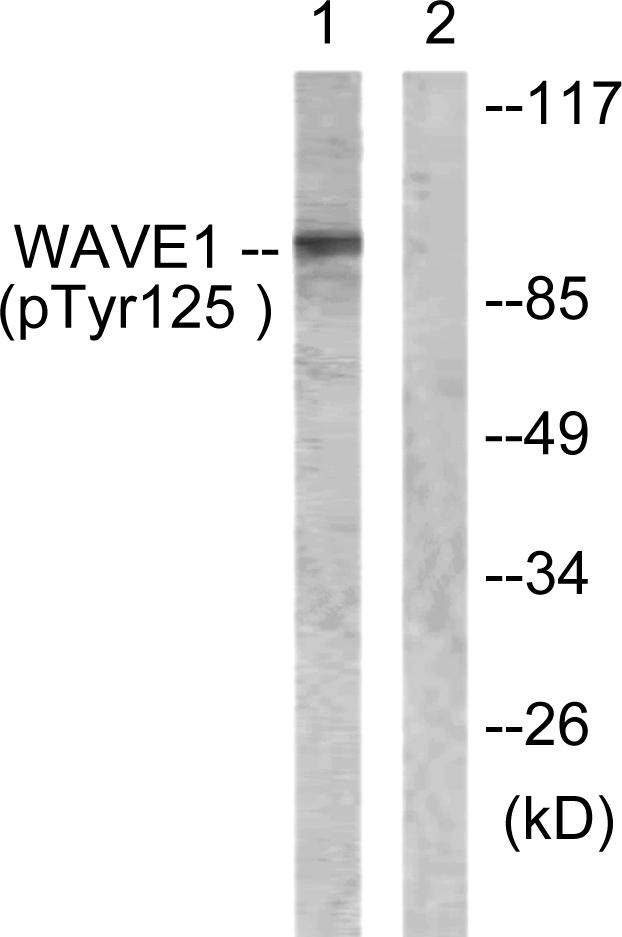 WASF1 / WAVE Antibody - Western blot analysis of lysates from NIH/3T3 cells treated with Insulin 0.01U/ml 15', using WAVE1 (Phospho-Tyr125) Antibody. The lane on the right is blocked with the phospho peptide.