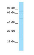 WASF2 / SCAR2 Antibody - SCAR2 / WAVE2 antibody Western Blot of Mouse Thymus.  This image was taken for the unconjugated form of this product. Other forms have not been tested.