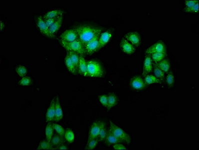 WASF2 / SCAR2 Antibody - Immunofluorescence staining of HepG2 cells at a dilution of 1:166, counter-stained with DAPI. The cells were fixed in 4% formaldehyde, permeabilized using 0.2% Triton X-100 and blocked in 10% normal Goat Serum. The cells were then incubated with the antibody overnight at 4 °C.The secondary antibody was Alexa Fluor 488-congugated AffiniPure Goat Anti-Rabbit IgG (H+L) .