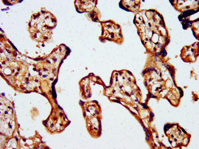 WASF2 / SCAR2 Antibody - Immunohistochemistry image at a dilution of 1:500 and staining in paraffin-embedded human placenta tissue performed on a Leica BondTM system. After dewaxing and hydration, antigen retrieval was mediated by high pressure in a citrate buffer (pH 6.0) . Section was blocked with 10% normal goat serum 30min at RT. Then primary antibody (1% BSA) was incubated at 4 °C overnight. The primary is detected by a biotinylated secondary antibody and visualized using an HRP conjugated SP system.