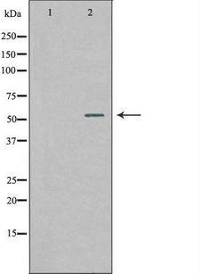 WASF2 / SCAR2 Antibody - Western blot analysis of extracts of 293 cells using WASF2 antibody. The lane on the left is treated with the antigen-specific peptide.