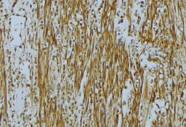 WASF2 / SCAR2 Antibody - 1:100 staining mouse muscle tissue by IHC-P. The sample was formaldehyde fixed and a heat mediated antigen retrieval step in citrate buffer was performed. The sample was then blocked and incubated with the antibody for 1.5 hours at 22°C. An HRP conjugated goat anti-rabbit antibody was used as the secondary.