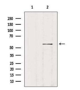 WASF2 / SCAR2 Antibody - Western blot analysis of extracts of B16F10 cells using WASF2 antibody. Lane 1 was treated with the blocking peptide.
