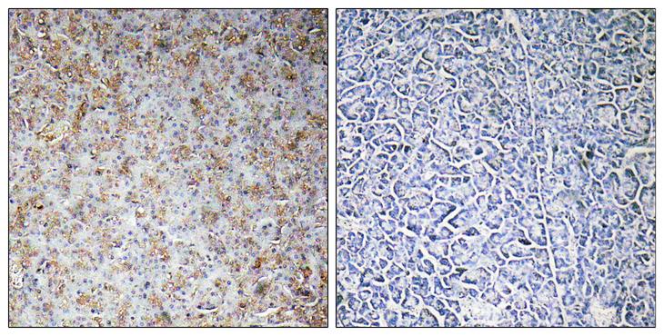 WASF2 / SCAR2 Antibody - Peptide - + Immunohistochemistry analysis of paraffin-embedded human pancreas tissue, using WASF2antibody.