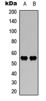WASF3 Antibody - Western blot analysis of WASF3 expression in HEK293T (A); mouse brain (B) whole cell lysates.