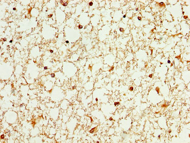 WASF3 Antibody - Immunohistochemistry image at a dilution of 1:100 and staining in paraffin-embedded human brain tissue performed on a Leica BondTM system. After dewaxing and hydration, antigen retrieval was mediated by high pressure in a citrate buffer (pH 6.0) . Section was blocked with 10% normal goat serum 30min at RT. Then primary antibody (1% BSA) was incubated at 4 °C overnight. The primary is detected by a biotinylated secondary antibody and visualized using an HRP conjugated SP system.