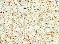 WASF3 Antibody - Immunohistochemistry image at a dilution of 1:100 and staining in paraffin-embedded human brain tissue performed on a Leica BondTM system. After dewaxing and hydration, antigen retrieval was mediated by high pressure in a citrate buffer (pH 6.0) . Section was blocked with 10% normal goat serum 30min at RT. Then primary antibody (1% BSA) was incubated at 4 °C overnight. The primary is detected by a biotinylated secondary antibody and visualized using an HRP conjugated SP system.