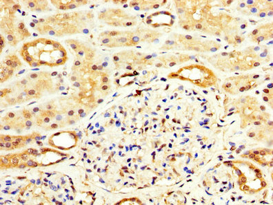 WASF3 Antibody - Immunohistochemistry image at a dilution of 1:100 and staining in paraffin-embedded human kidney tissue performed on a Leica BondTM system. After dewaxing and hydration, antigen retrieval was mediated by high pressure in a citrate buffer (pH 6.0) . Section was blocked with 10% normal goat serum 30min at RT. Then primary antibody (1% BSA) was incubated at 4 °C overnight. The primary is detected by a biotinylated secondary antibody and visualized using an HRP conjugated SP system.