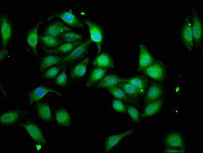 WASF3 Antibody - Immunofluorescence staining of A549 cells with WASF3 Antibody at 1:33, counter-stained with DAPI. The cells were fixed in 4% formaldehyde, permeabilized using 0.2% Triton X-100 and blocked in 10% normal Goat Serum. The cells were then incubated with the antibody overnight at 4°C. The secondary antibody was Alexa Fluor 488-congugated AffiniPure Goat Anti-Rabbit IgG(H+L).