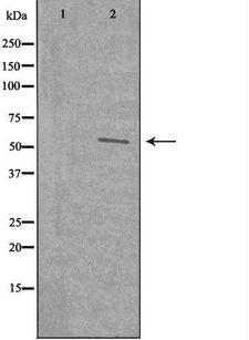 WASF3 Antibody - Western blot analysis of extracts of 3T3 cells using WASF3 antibody.