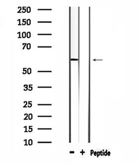 WASF3 Antibody - Western blot analysis of extracts of mouse heart tissue using WASF3 antibody.