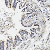 WASF3 Antibody - Immunohistochemistry of paraffin-embedded Human lung using WASF3 Polyclonal Antibody at dilution of 1:100 (40x lens).