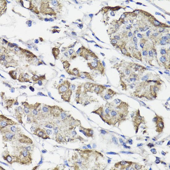 WASF3 Antibody - Immunohistochemistry of paraffin-embedded Human stomach using WASF3 Polyclonal Antibody at dilution of 1:100 (40x lens).
