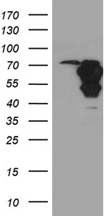 WASL / N-WASP Antibody - HEK293T cells were transfected with the pCMV6-ENTRY control. (Left lane) or pCMV6-ENTRY WASL. (Right lane) cDNA for 48 hrs and lysed. Equivalent amounts of cell lysates. (5 ug per lane) were separated by SDS-PAGE and immunoblotted with anti-WASL. (1:2000)