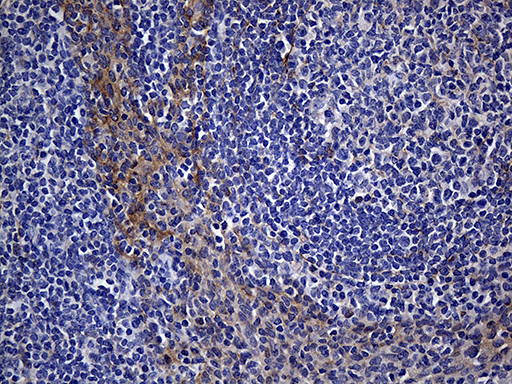 WASL / N-WASP Antibody - Immunohistochemical staining of paraffin-embedded Human tonsil within the normal limits using anti-WASL mouse monoclonal antibody. (Heat-induced epitope retrieval by 1mM EDTA in 10mM Tris buffer. (pH8.5) at 120°C for 3 min. (1:150)