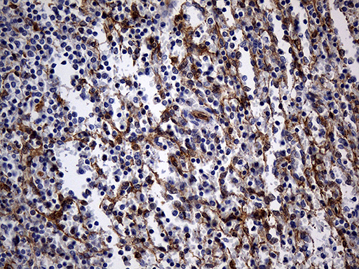WASL / N-WASP Antibody - Immunohistochemical staining of paraffin-embedded Human spleen tissue within the normal limits using anti-WASL mouse monoclonal antibody. (Heat-induced epitope retrieval by 1mM EDTA in 10mM Tris buffer. (pH8.5) at 120°C for 3 min. (1:150)
