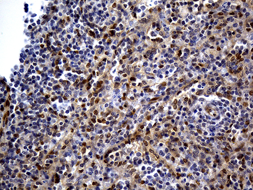 WASL / N-WASP Antibody - Immunohistochemical staining of paraffin-embedded Human spleen tissue within the normal limits using anti-WASL mouse monoclonal antibody. (Heat-induced epitope retrieval by 1mM EDTA in 10mM Tris buffer. (pH8.5) at 120°C for 3 min. (1:500)