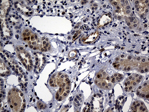 WASL / N-WASP Antibody - Immunohistochemical staining of paraffin-embedded Human Kidney tissue within the normal limits using anti-WASL mouse monoclonal antibody. (Heat-induced epitope retrieval by 1mM EDTA in 10mM Tris buffer. (pH8.5) at 120°C for 3 min. (1:500)