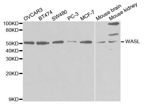 WASL / N-WASP Antibody - Western blot analysis of extracts of various cell lines.
