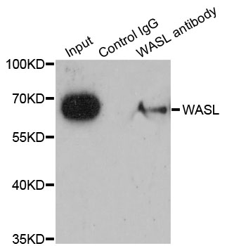 WASL / N-WASP Antibody - Immunoprecipitation analysis of 200ug extracts of MCF-7 cells.