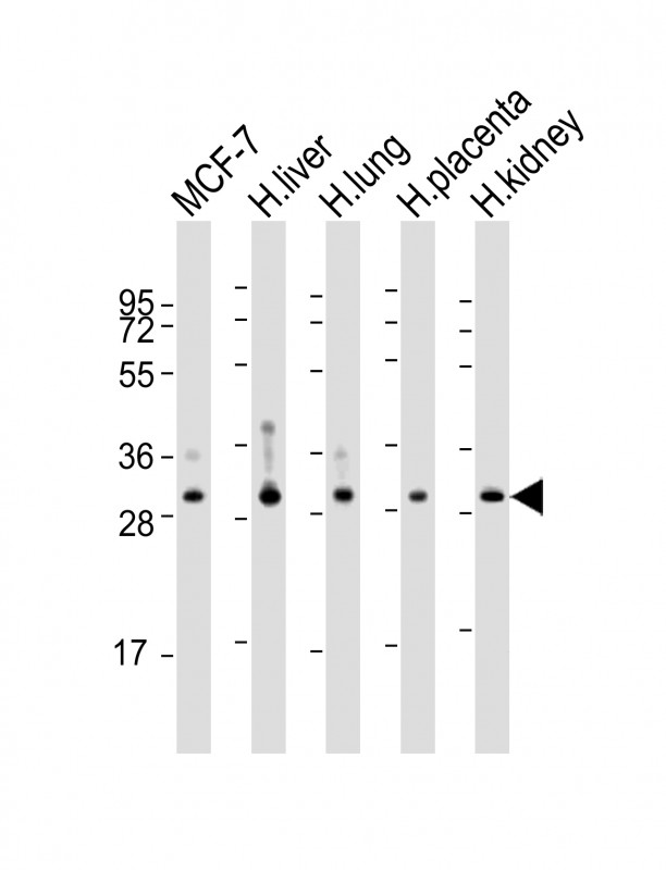 WBP1 Antibody - All lanes: Anti-WBP1 Antibody (C-Term) at 1:2000-1:4000 dilution. Lane 1: MCF-7 whole cell lysate. Lane 2: human liver lysate. Lane 3: human lung lysate. Lane 4: human placenta lysate. Lane 5: human kidney lysate Lysates/proteins at 20 ug per lane. Secondary Goat Anti-Rabbit IgG, (H+L), Peroxidase conjugated at 1:10000 dilution. Predicted band size: 29 kDa. Blocking/Dilution buffer: 5% NFDM/TBST.