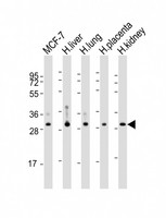 WBP1 Antibody - All lanes: Anti-WBP1 Antibody (C-Term) at 1:2000-1:4000 dilution. Lane 1: MCF-7 whole cell lysate. Lane 2: human liver lysate. Lane 3: human lung lysate. Lane 4: human placenta lysate. Lane 5: human kidney lysate Lysates/proteins at 20 ug per lane. Secondary Goat Anti-Rabbit IgG, (H+L), Peroxidase conjugated at 1:10000 dilution. Predicted band size: 29 kDa. Blocking/Dilution buffer: 5% NFDM/TBST.