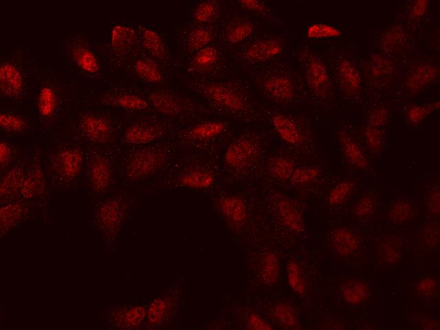 WBP11 Antibody - Immunofluorescence staining of WBP11 in U2OS cells. Cells were fixed with 4% PFA, permeabilzed with 0.1% Triton X-100 in PBS, blocked with 10% serum, and incubated with rabbit anti-Human WBP11 polyclonal antibody (dilution ratio 1:100) at 4°C overnight. Then cells were stained with the Alexa Fluor 594-conjugated Goat Anti-rabbit IgG secondary antibody (red). Positive staining was localized to Nucleus and cytoplasm.