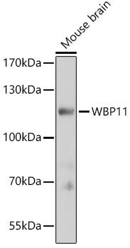 WBP11 Antibody - Western blot analysis of extracts of Mouse brain using WBP11 Polyclonal Antibody at dilution of 1:3000.